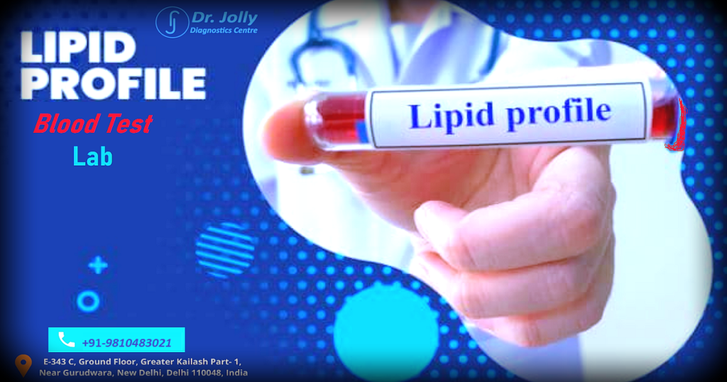 best-laboratory-lipid-profile-test-blood-test-health-checkup